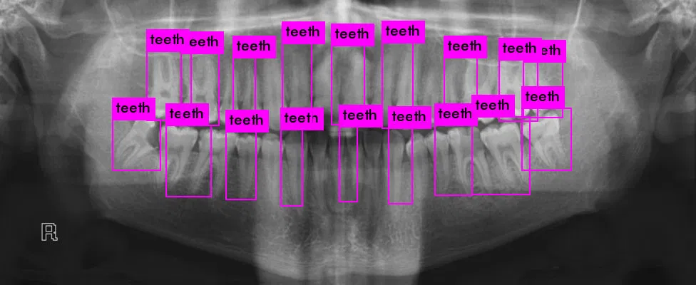 Image describing Xmile Tech - Dental Biometrics Platform 